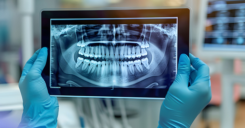 x-ray